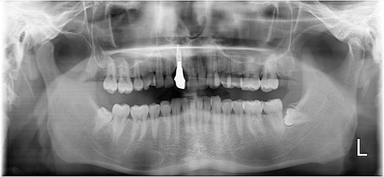 Case01 治療後の写真2
