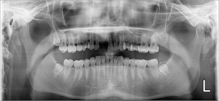 Case01 治療前の写真2