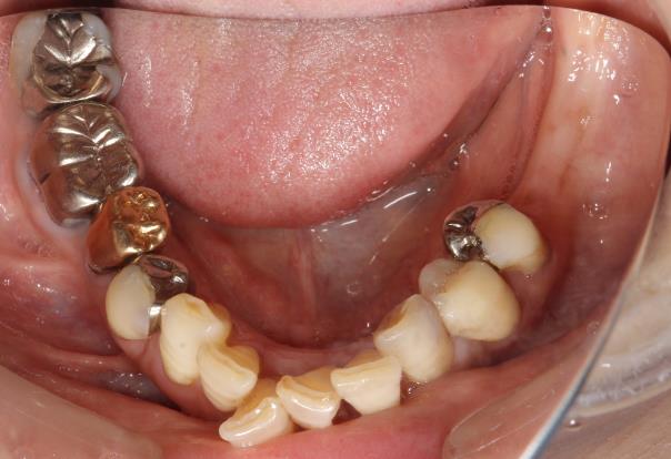Case02 治療前の写真2