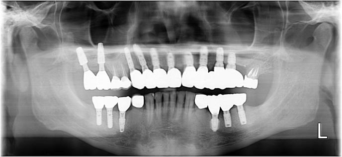 Case03 治療後の写真2