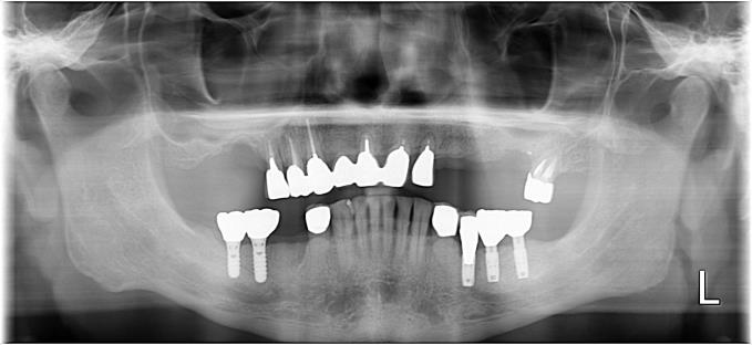 Case03 治療前の写真2