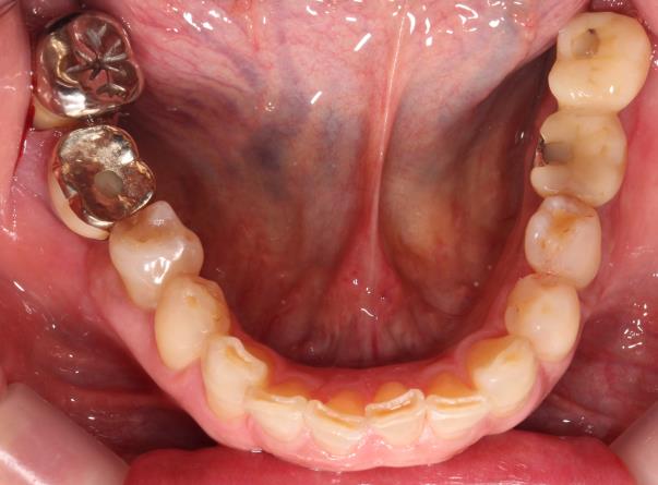 Case04 治療後の写真2