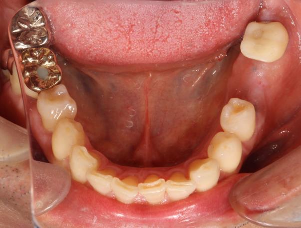 Case04 治療前の写真2