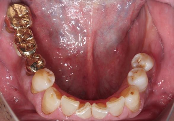 Case05 治療前の写真2