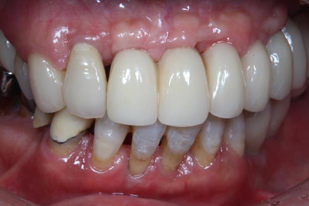 Case06 治療後の写真2