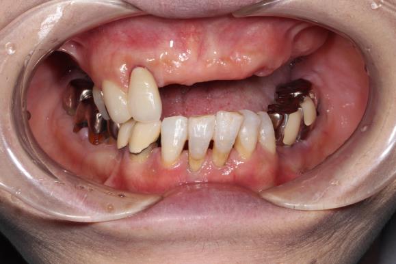 Case06 治療前の写真2