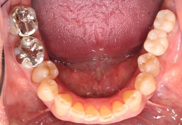 Case07 治療後の写真2