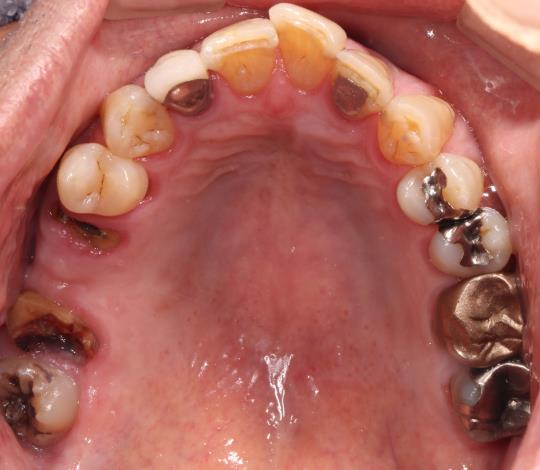 Case07 治療前の口腔内写真