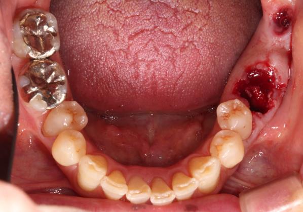 Case07 治療前の写真2
