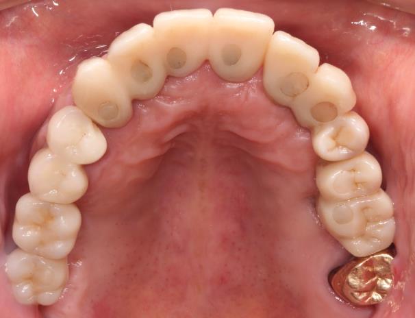 Case08 治療後の口腔内写真