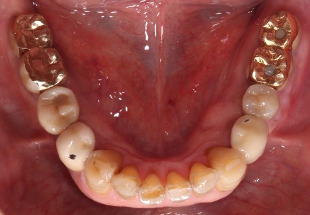 Case08 治療後の写真2