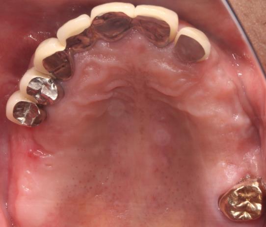 Case08 治療前の口腔内写真