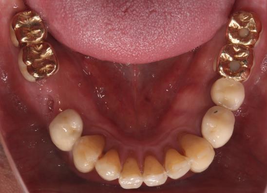 Case08 治療前の写真2