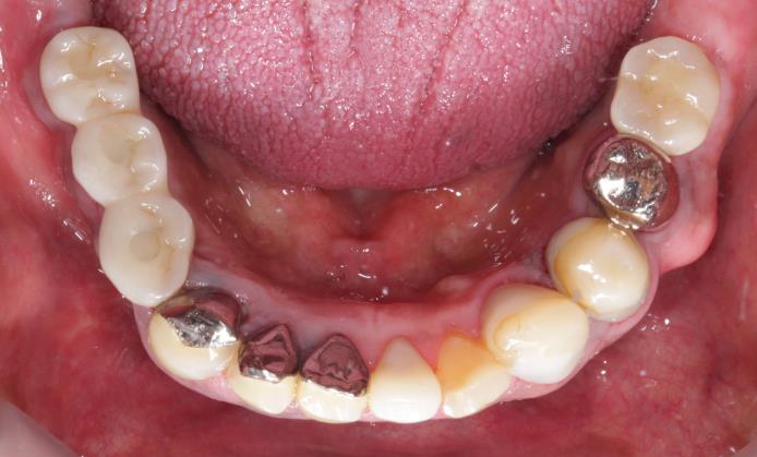 Case09 治療後の写真2