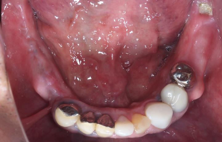 Case09 治療前の写真2