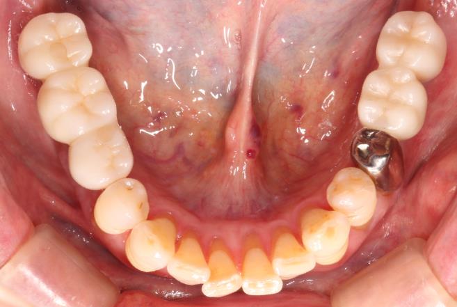 Case10 治療後の写真2