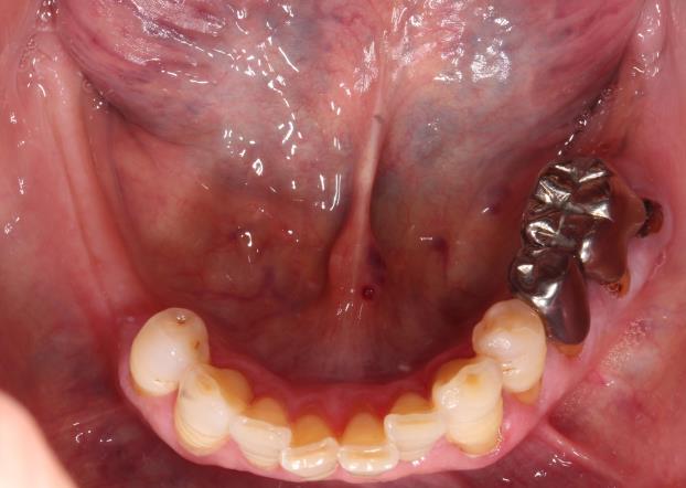 Case10 治療前の写真2