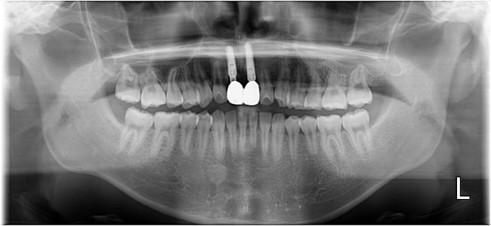 Case11 治療後の写真2