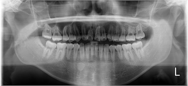 Case11 治療前の写真2