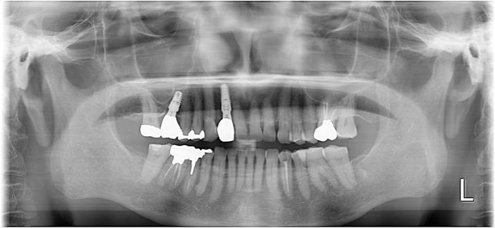 Case12 治療後の写真2