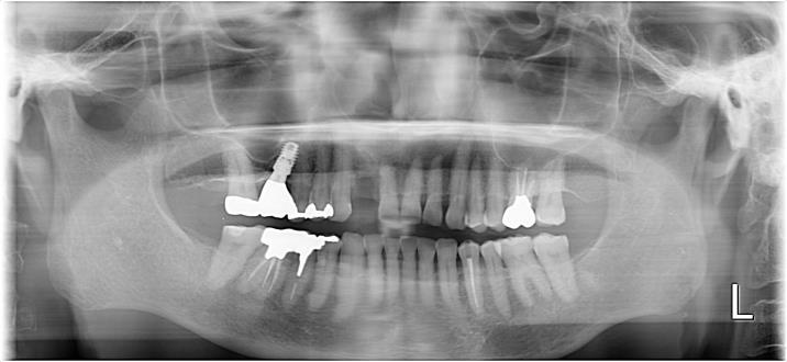 Case12 治療前の写真2