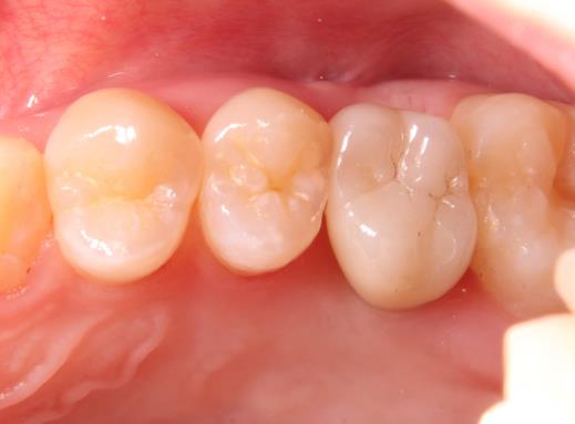 Case13 治療後の写真2