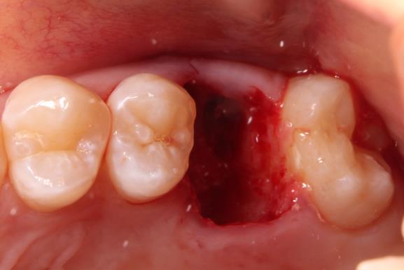 Case13 治療前の写真2