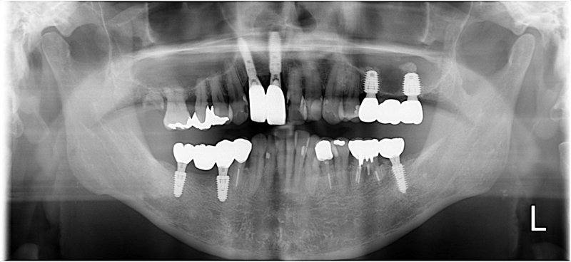 Case15 治療後の写真2