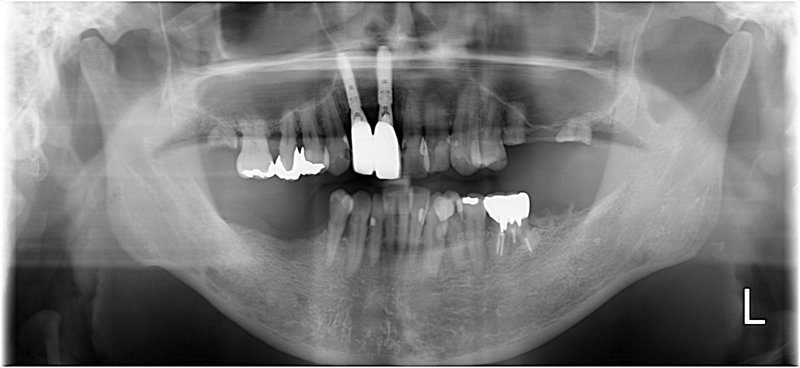 Case15 治療前の写真2
