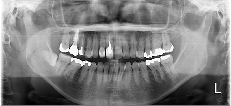 Case16 治療後の写真2