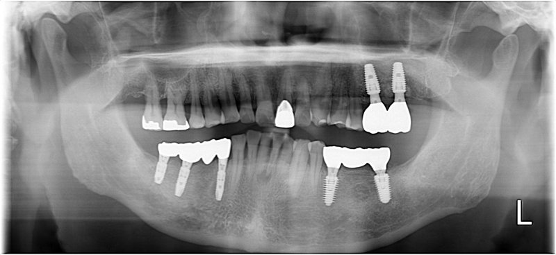 Case17 治療後の写真2