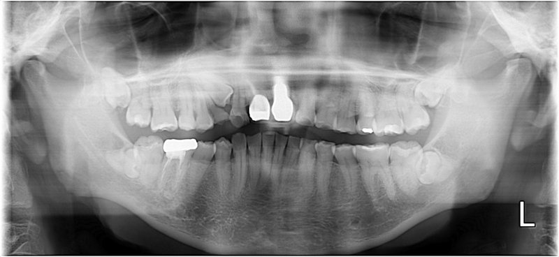 Case18 治療後の写真2