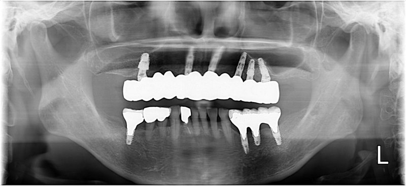 Case20 治療後の写真2