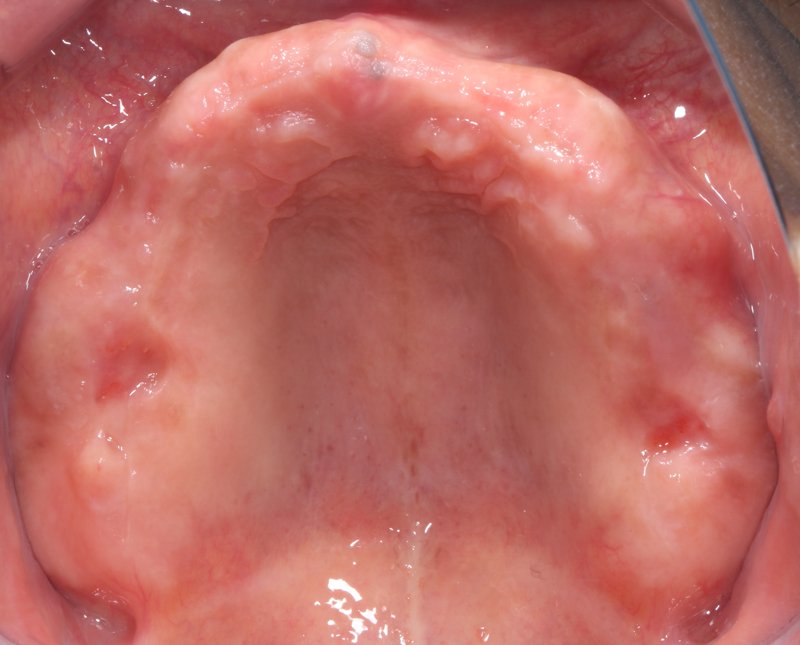 Case20 治療前の口腔内写真