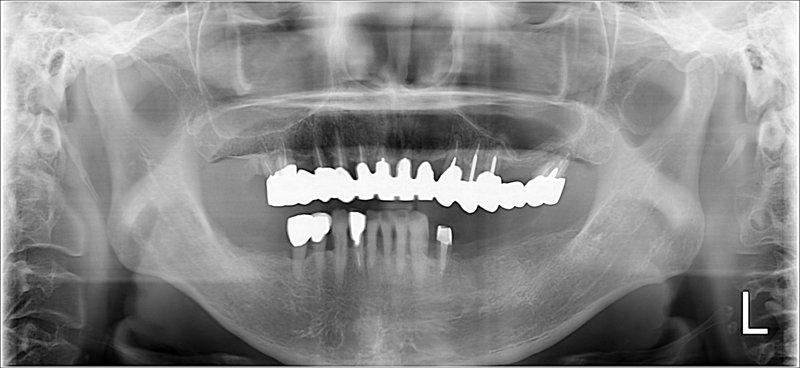 Case20 治療前の写真2